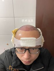 点击看大图 -碧莲盛·不剃发植发