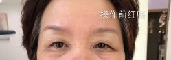 -久匠半永久纹眉