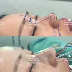 -郑州米兰柏羽集美医疗美容医院