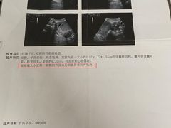 -浙江大学医学院附属邵逸夫医院(钱塘院区)