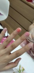 -初樱科技美学问题肌修复中心