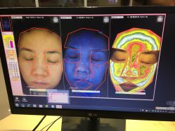 皮肤检测-光SPA科技美肤