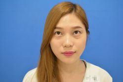 -广州健丽·去眼袋医疗美容机构