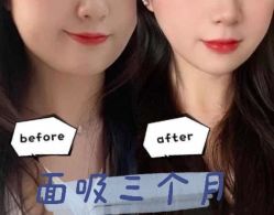 -上海漾颜医疗美容