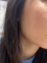 -广州美莱医疗美容医院