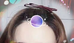 -大麦微针植发全国连锁