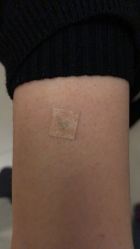 -肥三针腧穴瘦身馆