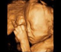 -郑州万安妇产医院