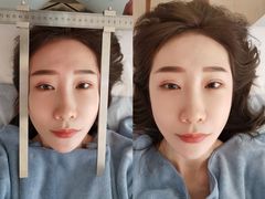 -FACE·日本小颜美容整骨(福田店)