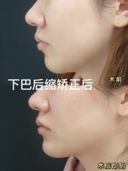 -美莱医学美容医院