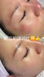 -宥莉·ULLY 痘敏肌•科技皮肤管理中心