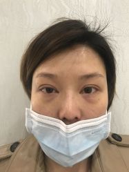 -天津健丽·去眼袋医疗美容机构