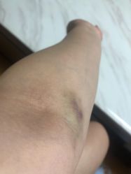 -北京市朝阳区妇幼保健院(南院区)