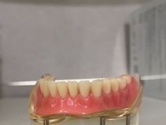 -上海仁爱医院口腔科 · 种植