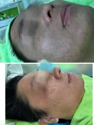 -苗医生0感祛痘连锁