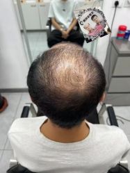 -唐风采假发补发定制