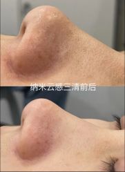 -SKIN79皮肤管理中心