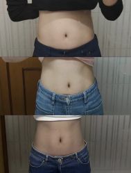 -Lily纤美·科技减脂中心