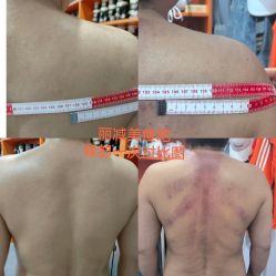 -丽减美瘦吧·减肥瘦身