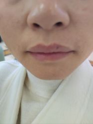 -长沙雅美医疗美容医院