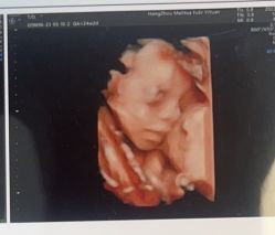 -杭州贝瑞斯美华妇儿医院·早孕·产检·儿科