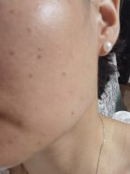 -丽美妍医疗美容·皮秒·立体分层抗衰