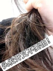 -大麦微针植发全国连锁