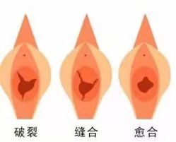 -邢台妇产医院