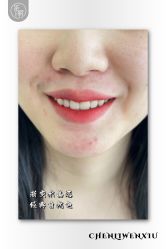 -臣丽纹眉品牌连锁