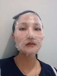 体验后-素妍医疗美容抗衰中心