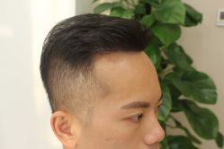 -大麦微针植发丨全国连锁