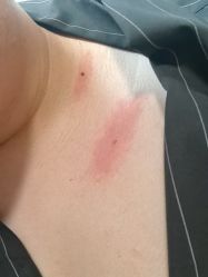 -北京美痣堂古方祛痣斑疣瘊