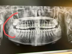 -华颜美口腔矫正·种植牙
