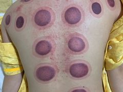 -脊艾堂正骨·推拿(牛王庙店)