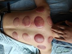 -艾通康缘艾灸.疼痛.睡眠养生馆(凤凰城店)