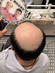 -唐风采假发补发定制