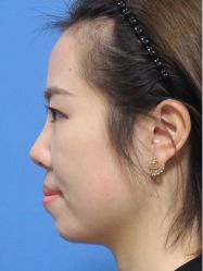 -深圳艺星医疗美容医院