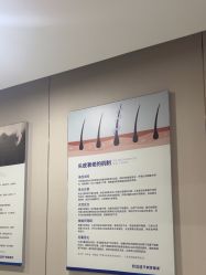 -碧莲盛不剃发植发