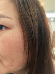 -长沙雅美医疗美容医院