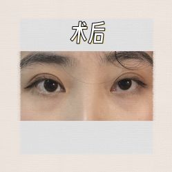 -素美医疗美容·西南眼鼻整形·修复基地