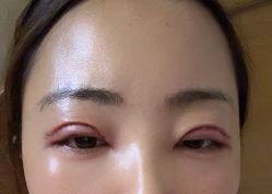体验后-广州美莱医疗美容医院