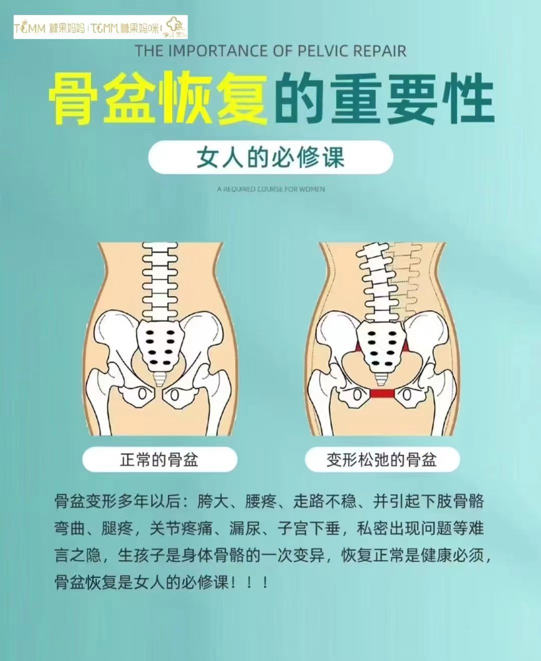 骨盆修复美容院大概多少钱一次(骨盆修复美容院大概多少钱一次啊)