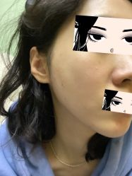 体验后-恒妍医美·韩国定制抗衰中心