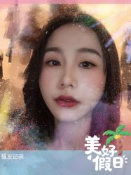 -大麦微针植发全国连锁