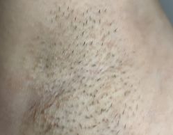 -素美医疗美容·西南眼鼻整形·修复基地