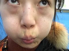 体验前-上海华安整形外科门诊部