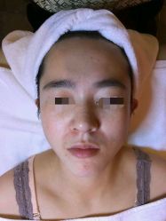 -皇族养心堂·净痘·修敏·御颜