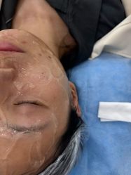 体验后-上海伊莱美医疗美容医院