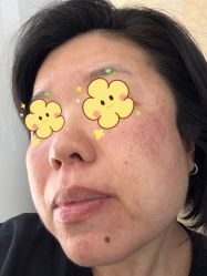 体验后-澳尔颜选医疗美容