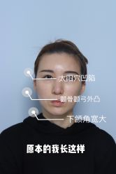 -大华韩艺整形美容医院